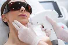 Client experiencing comfortable Cervello Painless laser hair removal at Kansas City's exclusive Aesthetics For Women clinic. Professional KC technician using advanced painless technology for permanent hair reduction with maximum comfort and effectiveness.